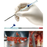 The MICROSS, minimally invasive autogenous bone collector, sterile